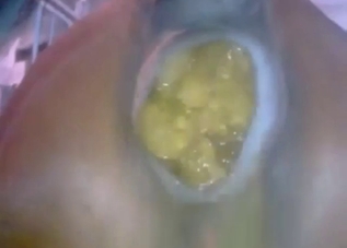 Close-up footage showing a mare shitting hard